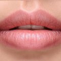 Kwas hialuronowy - powiększanie, modelowanie i korekta ust